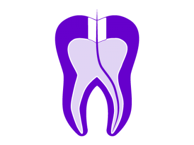 Endodoncia Donosti-San Sebastián