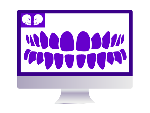 Implantes dentales con software 3D Donosti-San Sebastián