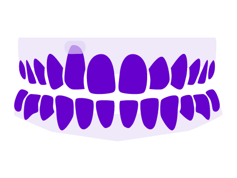 Periodoncia Donosti-San Sebastián