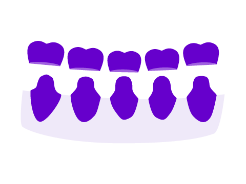Prótesis dental fija y removible Donosti-San Sebastián