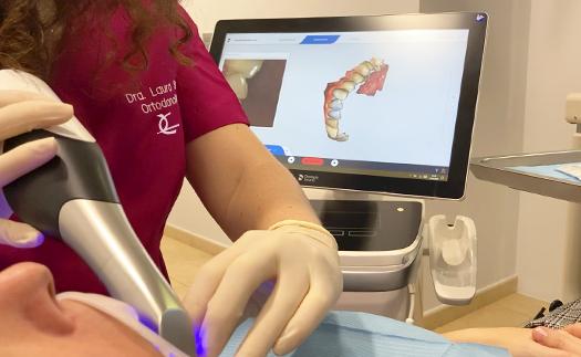 Noticia ¿Por qué es una revolución el escáner intraoral en 3D?